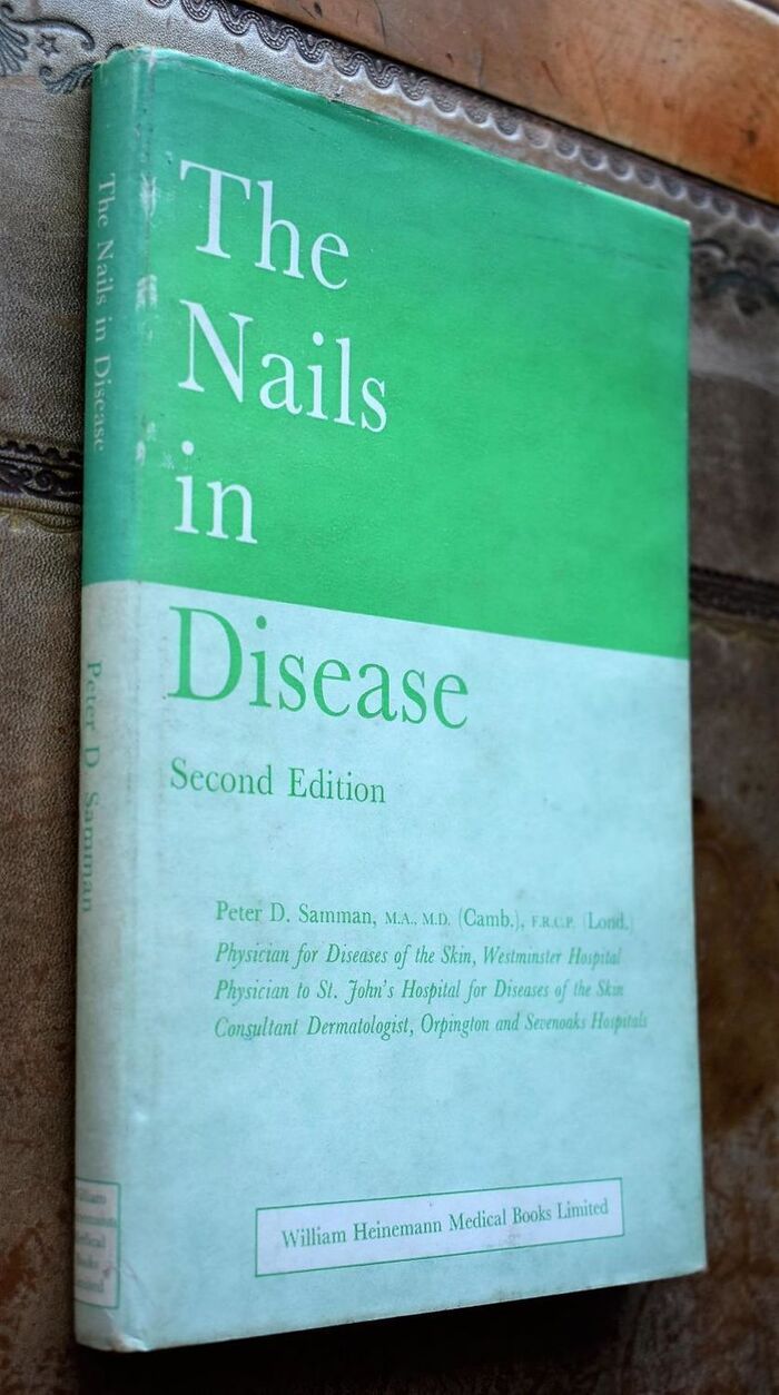The Nails In Disease Image